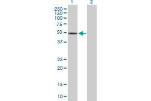 Western Blot analysis of ZNF718 expression in transfected 293T cell line by ZNF718 MaxPab polyclonal antibody. (ZNF718 antibody  (AA 1-478))