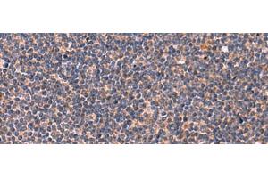 Immunohistochemistry of paraffin-embedded Human tonsil tissue using JAM3 Polyclonal Antibody at dilution of 1:45(x200) (JAM3 antibody)