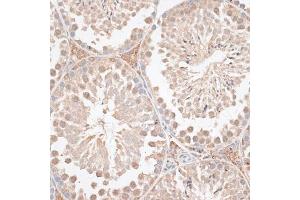 Immunohistochemistry of paraffin-embedded mouse testis using VEGF Receptor 2 antibody (ABIN6132247, ABIN6142816, ABIN6142819 and ABIN6215074) at dilution of 1:100 (40x lens). (VEGFR2/CD309 antibody  (AA 20-200))