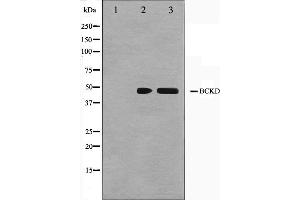Western blot analysis on Jurkat and K562 cell lysate using BCKD Antibody. (BCKDK antibody  (N-Term))