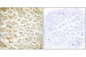 Immunohistochemistry analysis of paraffin-embedded human heart tissue, using Collagen XIV alpha1 Antibody. (COL14A1 antibody  (AA 71-120))