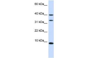 DBI antibody used at 1 ug/ml to detect target protein.