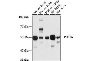 Western blot analysis of extracts of various cell lines, using PDE1A antibody (ABIN6131333, ABIN6145346, ABIN6145347 and ABIN6214718) at 1:1000 dilution. (PDE1A antibody  (AA 446-545))