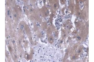 DAB staining on IHC-P; Samples: Human Liver Tissue (CANT1 antibody  (AA 107-400))