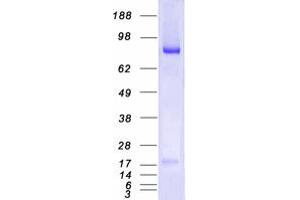 MALT1 Protein (Transcript Variant 1) (Myc-DYKDDDDK Tag)