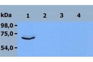 Western Blotting (WB) image for anti-zeta-Chain (TCR) Associated Protein Kinase 70kDa (ZAP70) (C-Term) antibody (ABIN238530) (ZAP70 antibody  (C-Term))