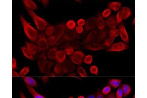Immunofluorescence analysis of HeLa cells using VDAC3 Polyclonal Antibody at dilution of 1:100 (40x lens). (VDAC3 antibody)