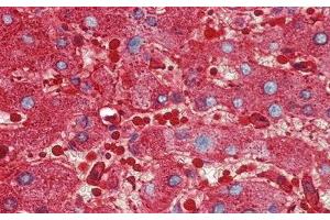 Detection of FE in Human Liver Tissue using Polyclonal Antibody to Ferritin (FE)