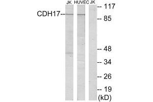 Western Blotting (WB) image for anti-LI Cadherin (Internal Region) antibody (ABIN1850218) (LI Cadherin antibody  (Internal Region))