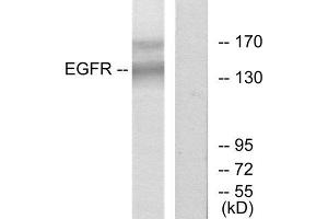 Western Blotting (WB) image for anti-Epidermal Growth Factor Receptor (EGFR) (Tyr1172) antibody (ABIN1848098) (EGFR antibody  (Tyr1172))