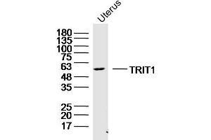 Mouse uterus lysates probed with TRIT1 Polyclonal Antibody, Unconjugated  at 1:300 dilution and 4˚C overnight incubation. (TRIT1 antibody  (AA 121-220))