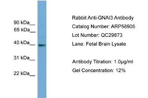 WB Suggested Anti-GNAI3  Antibody Titration: 0.
