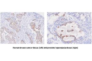 Immunohistochemistry (IHC) image for anti-Six Transmembrane Epithelial Antigen of The Prostate 1 (STEAP1) (AA 1-70), (N-Term) antibody (ABIN317568) (STEAP1 antibody  (N-Term))