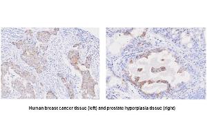 Immunohistochemistry (IHC) image for anti-Six Transmembrane Epithelial Antigen of The Prostate 1 (STEAP1) (AA 1-70), (N-Term) antibody (ABIN317568)