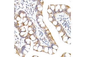 Immunohistochemistry of paraffin-embedded human small intestine using NDUF Rabbit mAb (ABIN7268797) at dilution of 1:50 (40x lens). (NDUFA1 antibody)