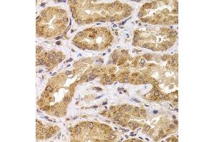 Immunohistochemistry of paraffin-embedded human kidney using  antibody (ABIN6127359, ABIN6136867, ABIN6136868 and ABIN6222919) at dilution of 1:100 (40x lens). (ANAPC5 antibody  (AA 1-250))
