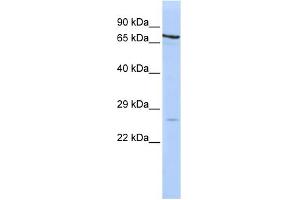 WB Suggested Anti-PSMB4 Antibody Titration: 0.
