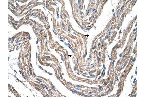 PDK4 antibody was used for immunohistochemistry at a concentration of 4-8 ug/ml to stain Skeletal muscle cells (arrows) in Human Muscle. (PDK4 antibody  (N-Term))