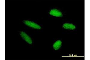 Immunofluorescence of purified MaxPab antibody to TRIM46 on HepG2 cell. (TRIM46 antibody  (AA 1-498))