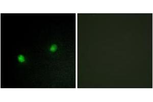 Immunofluorescence analysis of HeLa cells, using ZNF7 Antibody. (ZNF7 antibody  (AA 41-90))