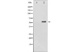 Western blot analysis of Chk2 phosphorylation expression in UV treated HeLa whole cell lysates,The lane on the left is treated with the antigen-specific peptide. (CHEK2 antibody  (pSer516))