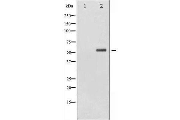 CHEK2 antibody  (pSer516)