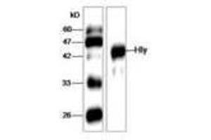 Image no. 1 for anti-Listeria Monocytogenes Hly (AA 20-119) antibody (ABIN791324) (Listeria Monocytogenes Hly (AA 20-119) antibody)