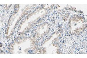 ABIN6276592 at 1/100 staining Human prostate tissue by IHC-P. (K-RAS antibody  (C-Term))