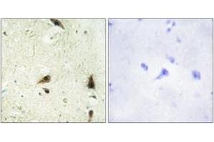 Immunohistochemistry analysis of paraffin-embedded human brain tissue, using CHRC1 Antibody. (CHRAC1 antibody  (AA 81-130))