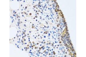 Immunohistochemistry of paraffin-embedded Rat lung using MTA3 Polyclonal Antibody at dilution of 1:100 (40x lens).