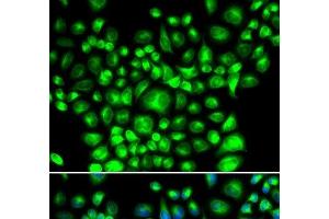 Immunofluorescence analysis of U2OS cells using BCAP31 Polyclonal Antibody (BCAP31 antibody)
