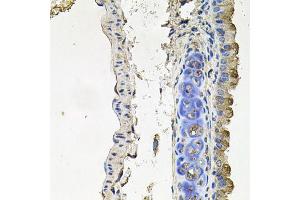 Immunohistochemistry of paraffin-embedded mouse lung using NDUFA6 antibody (ABIN6003563) at dilution of 1/100 (40x lens).