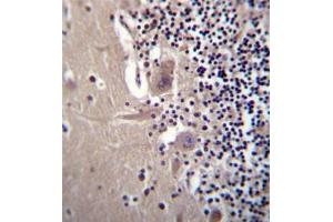 Formalin fixed, paraffin embedded human cerebellum tissue stained with Beta-crystallin A3 Antibody  followed by peroxidase conjugation of the secondary antibody and DAB staining. (CRYBA1 antibody  (Middle Region))