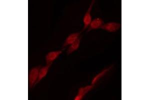 ABIN6266528 staining NIH-3T3 by IF/ICC. (POLB antibody  (C-Term))