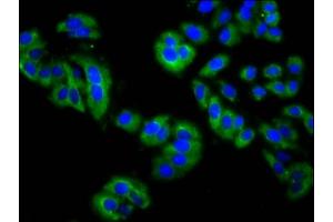 Immunofluorescence staining of HepG2 cells with ABIN7158901 at 1:200, counter-stained with DAPI. (MPP3 antibody  (AA 301-432))