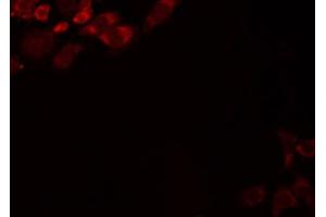 ABIN6274469 staining LOVO by IF/ICC. (JAKMIP2 antibody  (C-Term))