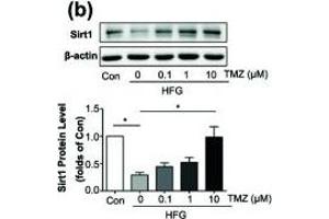 Trimetazidine (TMZ) reduced HFG-induced ROS generation and EMT depending on upregulation of Sirt1. (SIRT1 antibody  (AA 448-747))