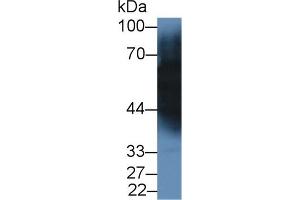 Detection of TF in Porcine Cerebrum lysate using Monoclonal Antibody to Transferrin (TF) (Transferrin antibody  (AA 318-453))