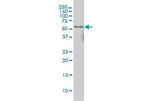 NFIC monoclonal antibody (M02A), clone 2C3. (NFIC antibody  (AA 314-423))