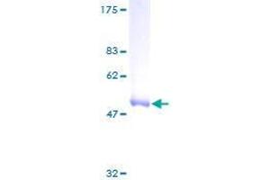RAB6B Protein (AA 1-208) (GST tag)