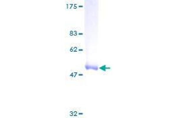 RAB6B Protein (AA 1-208) (GST tag)