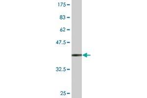 Western Blot detection against Immunogen (37. (SCTR antibody  (AA 32-141))