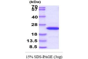 SDS-PAGE (SDS) image for GTPase NRas (NRAS) (AA 1-186) protein (ABIN667768)
