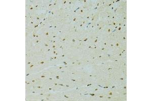 Immunohistochemistry of paraffin-embedded rat heart using RCC1 antibody (ABIN5973761) at dilution of 1/100 (40x lens). (RCC1 antibody)