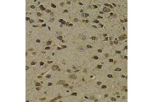 Immunohistochemistry of paraffin-embedded mouse brain using OGG1 antibody at dilution of 1:200 (400x lens). (OGG1 antibody)