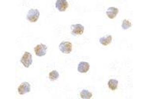 Immunocytochemistry of ATF6 in A20 with this product atF6 antibody at 10 μg/ml. (ATF6 antibody  (N-Term))