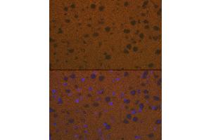 Immunofluorescence analysis of mouse brain cells using Talin 2 Rabbit mAb (ABIN7270720) at dilution of 1:100 (40x lens). (TLN2 antibody)