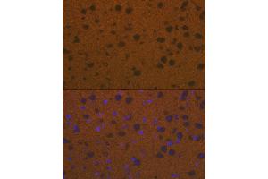 Immunofluorescence analysis of mouse brain cells using Talin 2 Rabbit mAb (ABIN7270720) at dilution of 1:100 (40x lens). (TLN2 antibody)