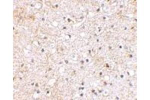Immunohistochemical staining of human brain tissue using AP30380PU-N Grik1 antibody at 2.