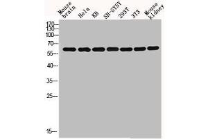 Western blot analysis of mouse-brain HELA KB SH-SY5Y 293T 3T3 Mouse-kidney lysis using GNL3L antibody. (GNL3L antibody  (Internal Region))
